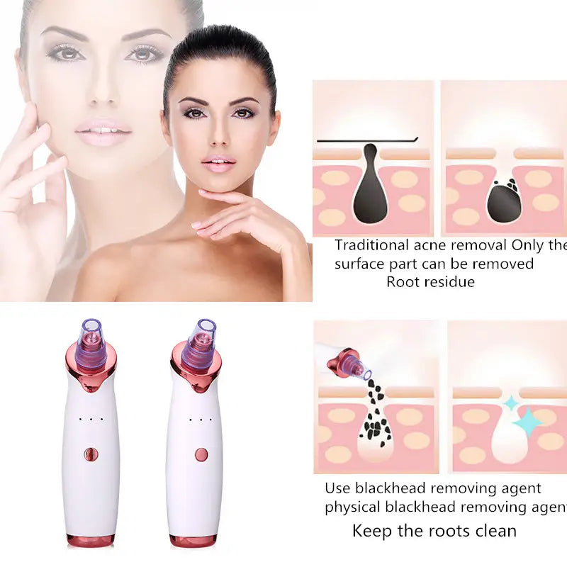 Black Head Remover Acne Vacuum Suction Face Pore Cleaning