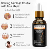 Best Effective Women Men Hair Care Repairing Promote Hair Growth Pure Natural Ginger Oil